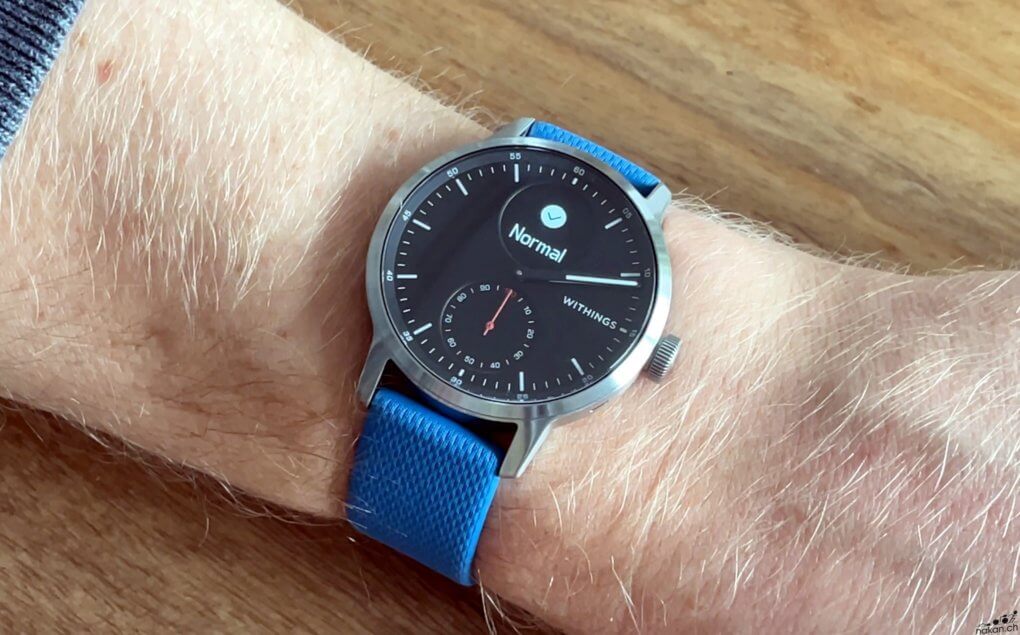 Withings ScanWatch 2 : prix, fiche technique, actualités et test